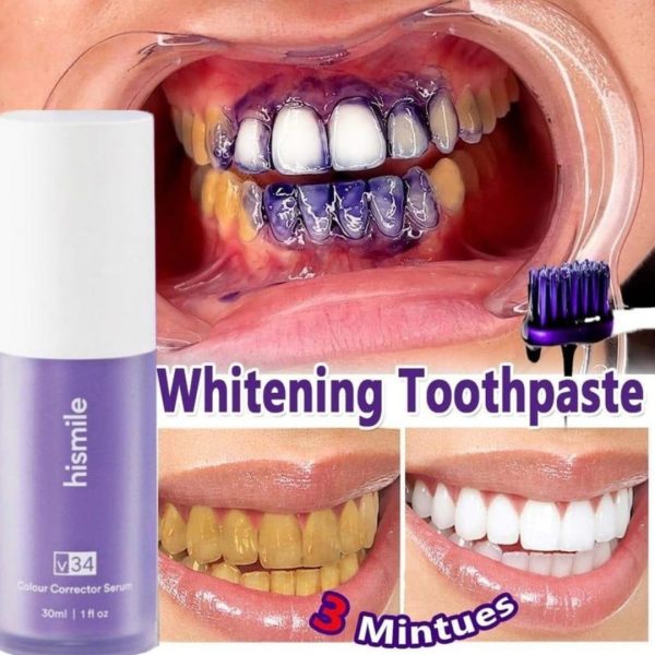 Hismile For Teeth Brightening