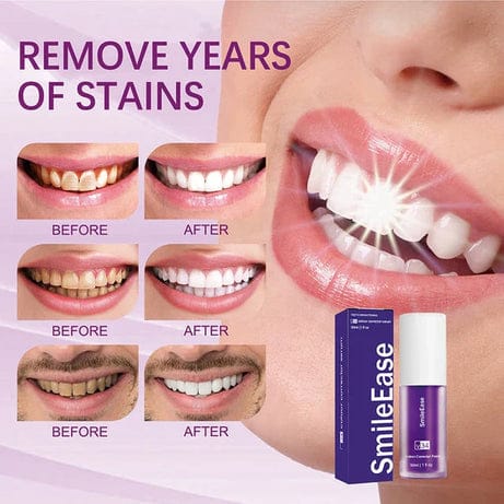 Hismile For Teeth Brightening